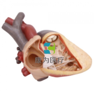 “康為醫(yī)療”心臟室間隔缺損模型