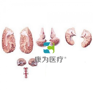 “康為醫(yī)療”腦與腦動(dòng)脈模型