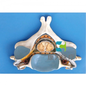 “康為醫(yī)療”第五頸椎附脊髓和脊神經(jīng)放大模型